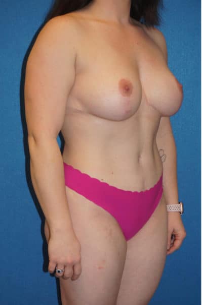 MM AFTER CROPPED JG 5