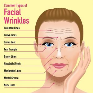 Facial Wrinkles diagram