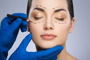 Eyelid Surgery Sacramento Ca