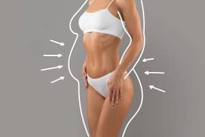 post bariatric plastic surgery