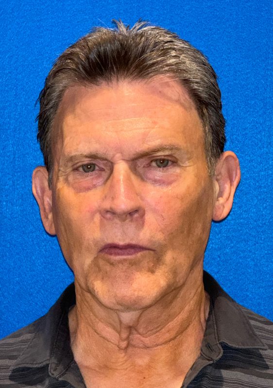 104807 facelift LA Pre 1