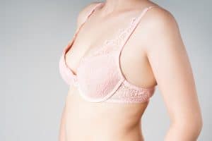 Woman after breast reduction surgery with a smaller breast size.